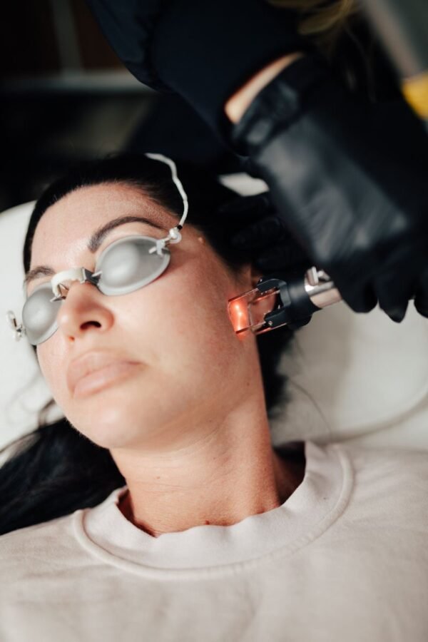 Picoway traitement hyperpigmentation