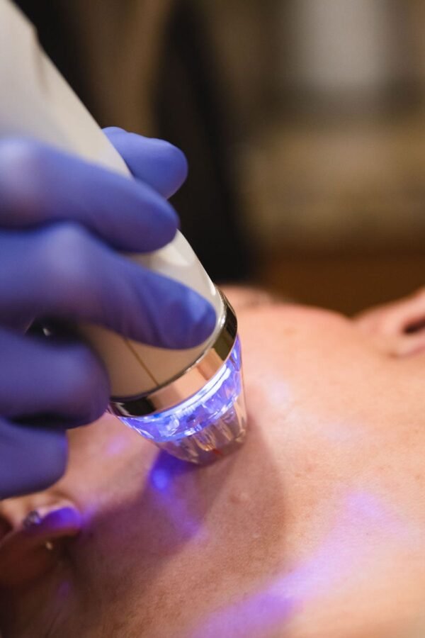 Pinxel microneedling RF