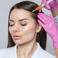 Mesotherapie du cuir chevelu